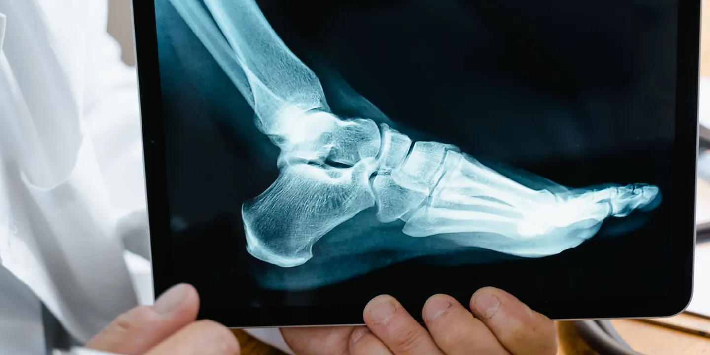 Clinician holding a tablet showing a foot X-ray while assessing whether specialist review is needed