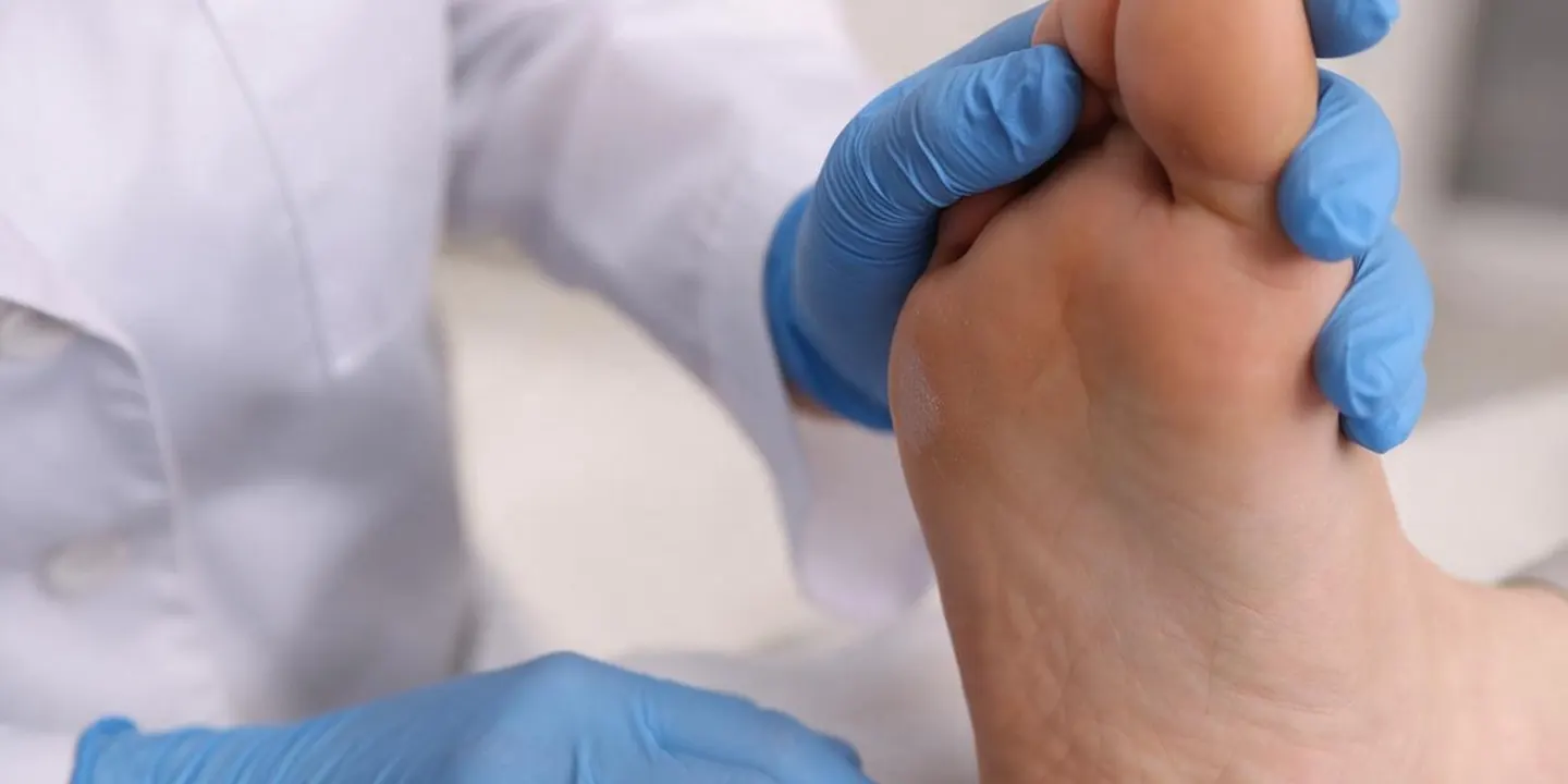 Gloved clinician examining the ball of a patient’s foot, the site of metatarsalgia pain